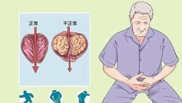 360截圖20220317113906186.jpg 前列腺凝膠OEM廠家